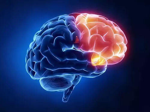 Tai biến mạch máu não lần 2 làm thế nào để cải thiện?